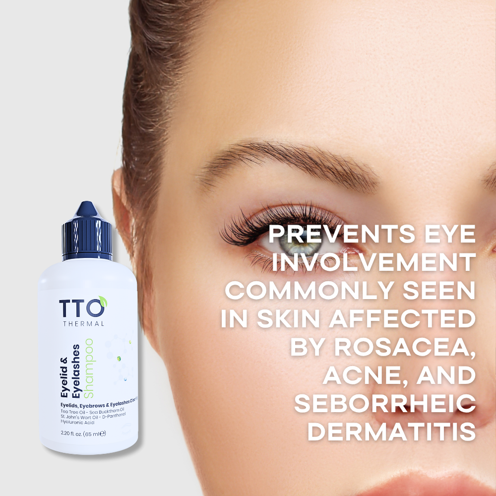 TTO Thermal Eyelid & Eyelashes Shampoo – 65ml
