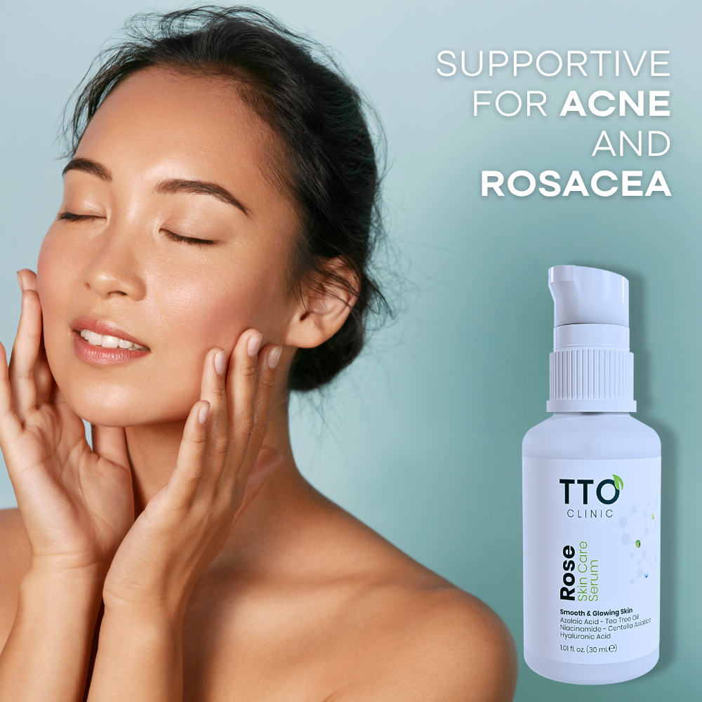 TTO Clinic Rose Skin Care Serum – 30ml